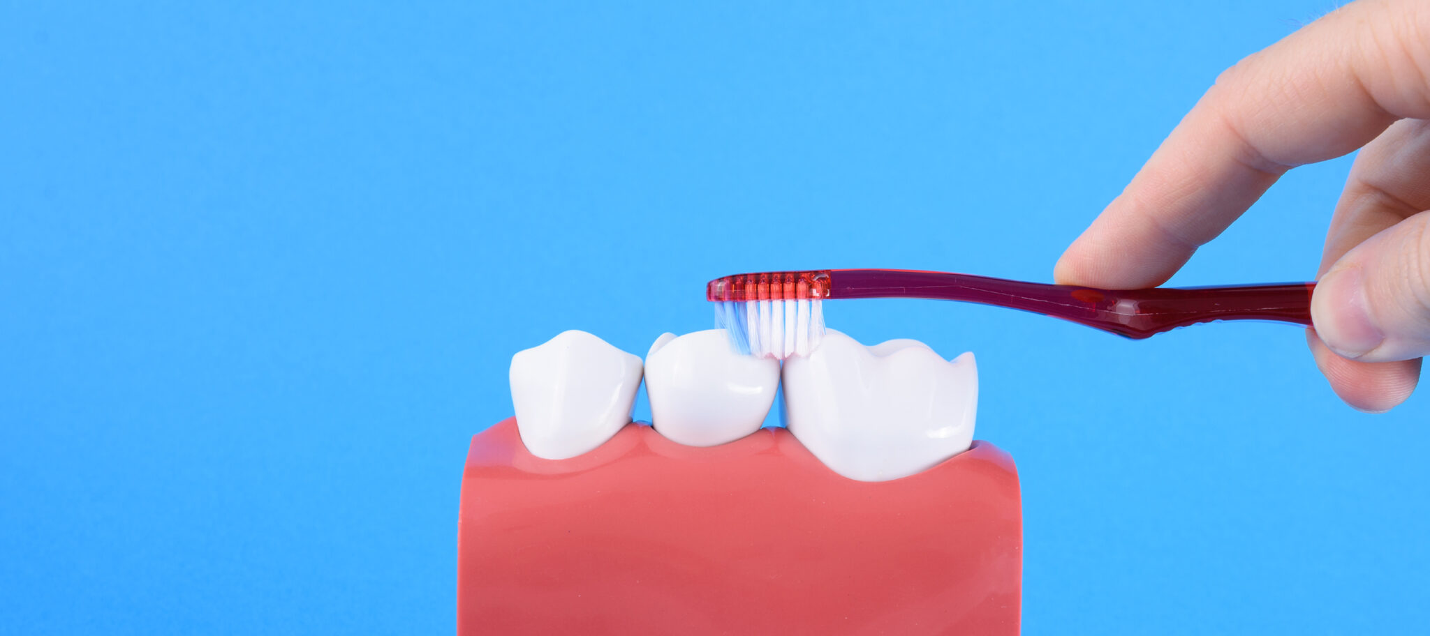 5 Tips To Prevent Tooth Decay Cavities Treatment Navi Mumbai SK